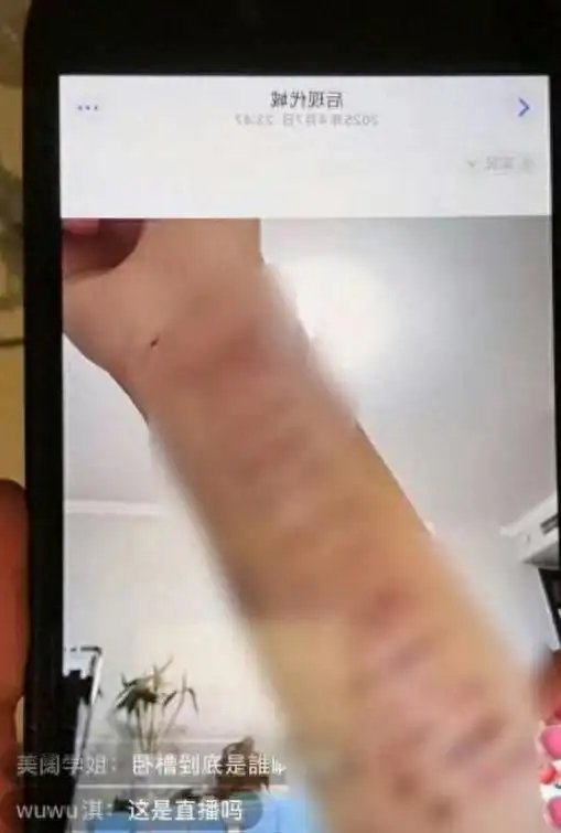 娱乐圈女艺人被注射不明物体 监控操控 AI换脸维权 深度合成技术 侵权_最近明星黑科技热点,